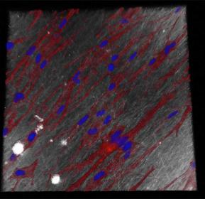 Fibroblasts (connective tissue cells) on the electrospun Renacer® membrane under the confocal microscope (red: cytoskeleton of the cells, blue: cell nuclei).