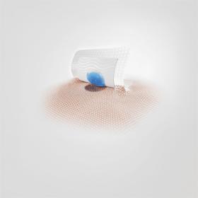 Tacnera® from Freudenberg solves the adhesion-trauma problem.