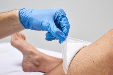 Tacnera: Freudenbergs innovative Technologie für silikonbeschichtete sekundäre Schaumverbände.