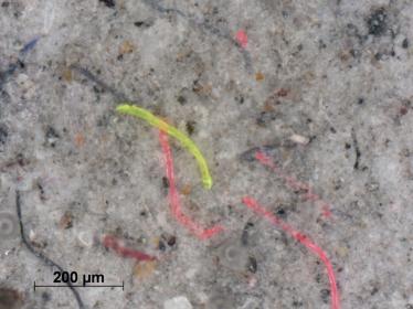 Beispielbild eines Filterkuchens mit abgelagerten Mikroplastikfasern. 